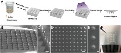 Microneedle-Based Device for Biological Analysis